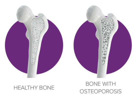 Bone diagram